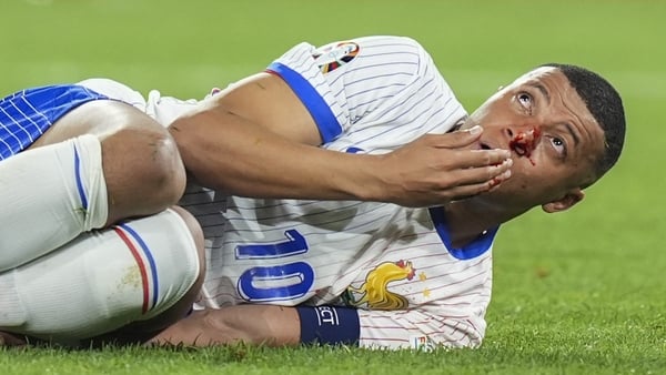 Kylian Mbappe bled profusely after colliding with the shoulder of Austrian defender Kevin Danso