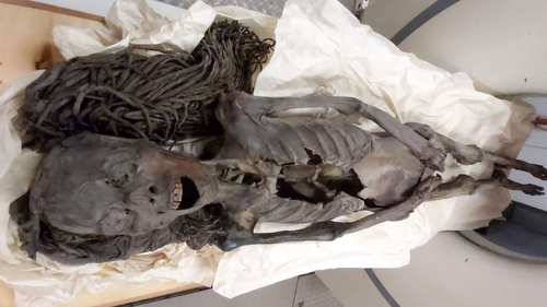 The ancient Egyptian mummy known as the Screaming Woman undergoing a CT scan