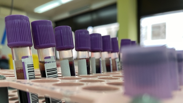 The ECDEC has said that more imported mpox cases to Europe were 'highly likely'