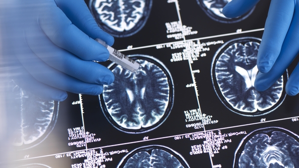 Patients will need a baseline MRI and either a Pet-CT scan or lumbar puncture to confirm Alzheimer's (Stock image)