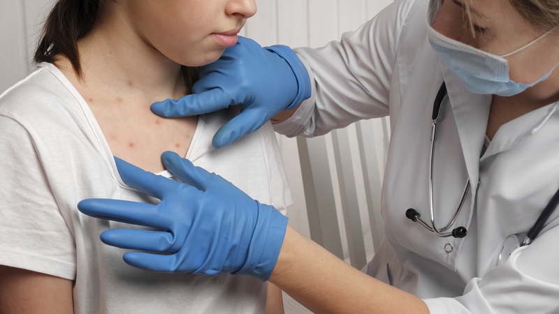 Passengers on the bus are asked to look out for signs and symptoms of measles for the next 2-3 weeks (Stock image)