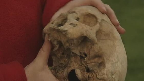 Skeletal remains in Swords, 1999