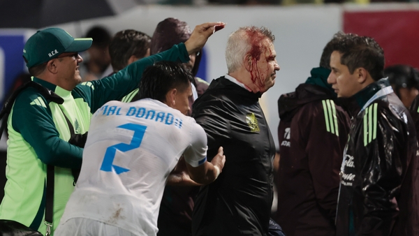 A bloodied Javier Aguirre leaves the pitch at General Francisco Morazan Stadium in San Pedro Sula
