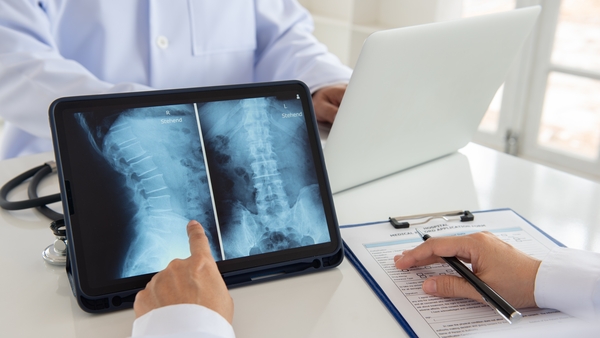 Minister for Health Jennifer Carroll MacNeill said the Government will not oppose legislation to create a national treatment service for scoliosis