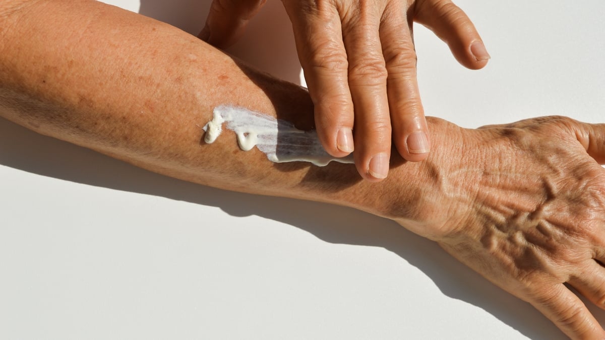 Dermatology expert: Festive skin flare-ups 