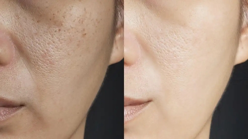 Experts reveal how to boost your skincare in the New Year (Alamy)