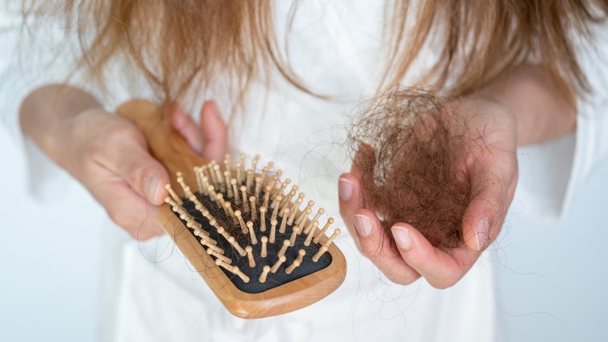 Hair loss – what treatments are available?
