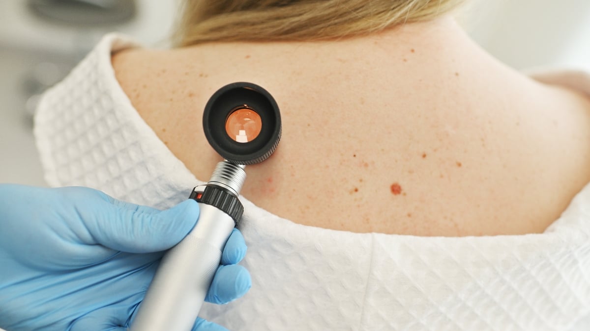 Skin pigmentation