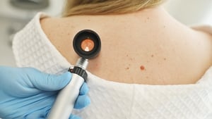 Skin pigmentation show image