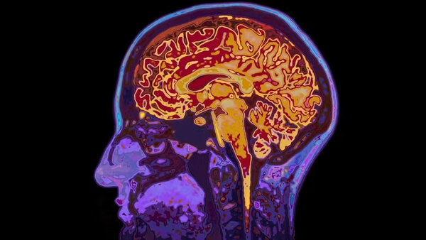 'Despite how important our brains are, many people still know very little about it'. Image: SpeedKingz/Shutterstock