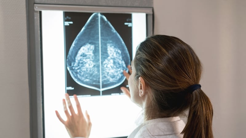 This year's target for BreastCheck was 219,000, but it is expected that just 170,000 will be screened (stock image)