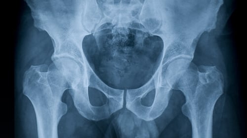 Dr Colm Henry said the surgeons believed the interventions were necessary and had evolved based on research (Stock image)