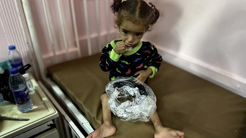 18-month-old Mayar El Arca is being treated at Nasser Hospital in Khan Younis