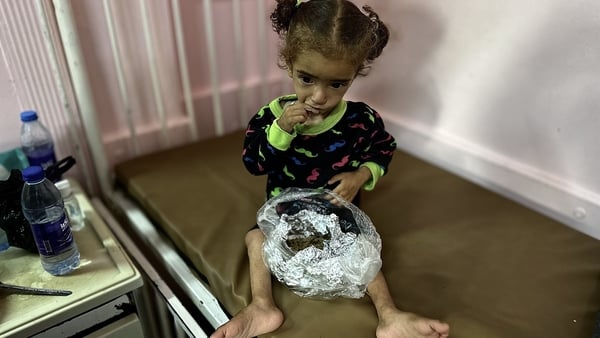 18-month-old Mayar El Arca is being treated at Nasser Hospital in Khan Younis