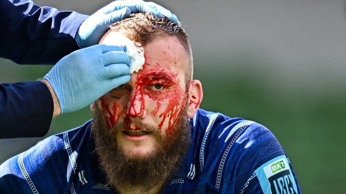 RG Snyman receives treatment for a cut during Leinster's win over Scarlets