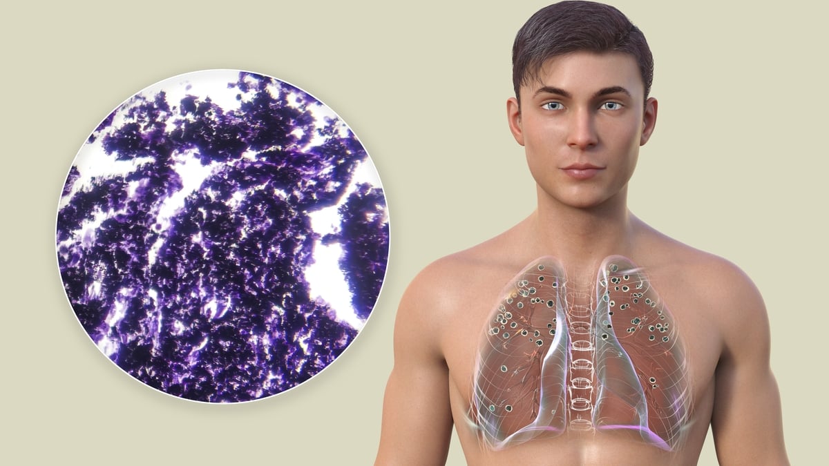 Concerns over Silica dust