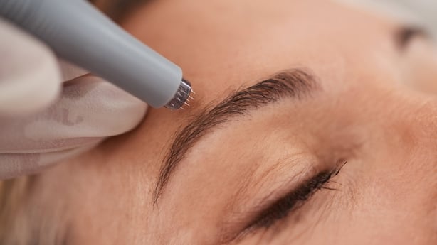 Close up photo of a woman having a micro-needling treatment