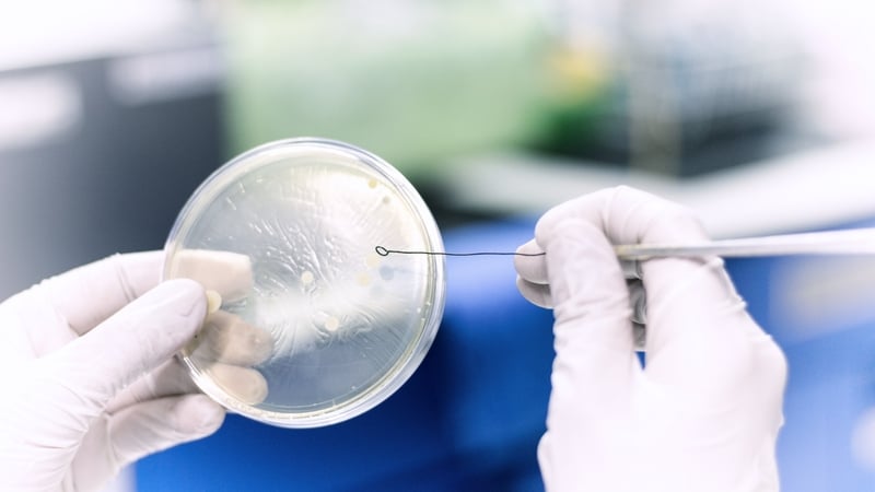 Microbiological testing; the microbiologist counting the colony of microbial in the plate