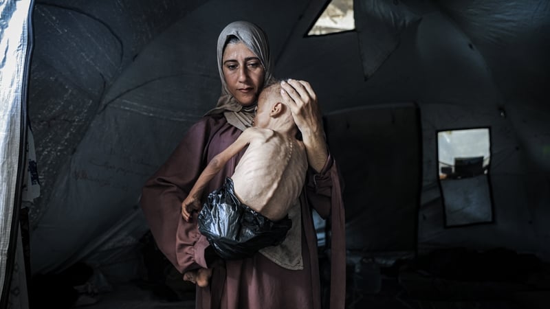 A mother holds her starving baby in Gaza City