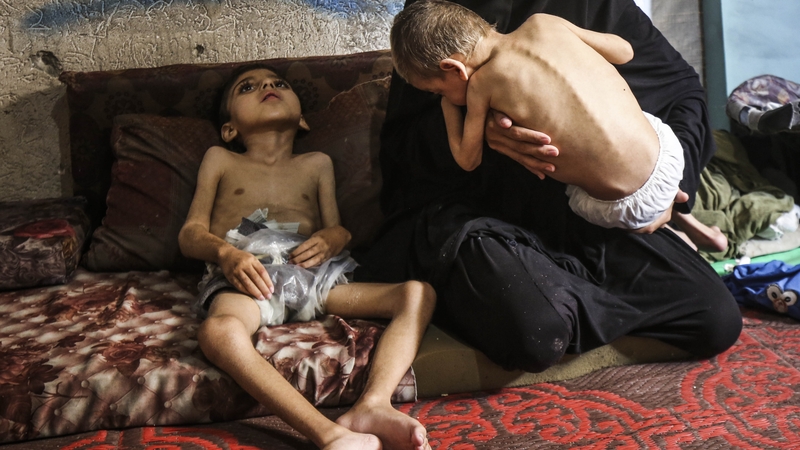 Severely malnourished six-year-old Yusuf Abdurrahman Matar and his four-year-old brother Emir Abdurrahman Matar are pictured in Gaza City