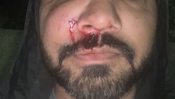 a person with a cut on his face