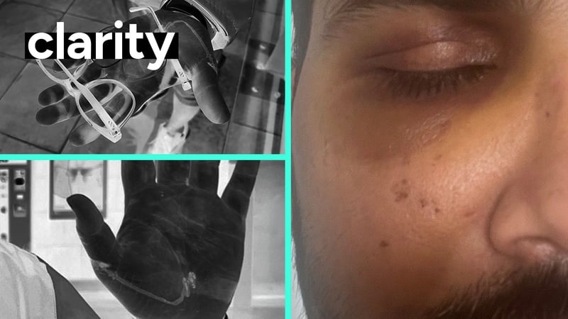 Dr Santosh Yadav says the impact of the attack has been severe