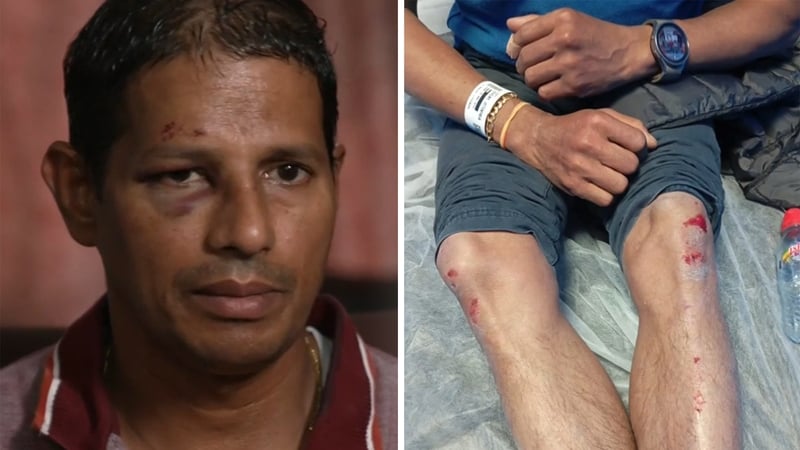 Laxman Das was cycling to his job when he was attacked on Wednesday