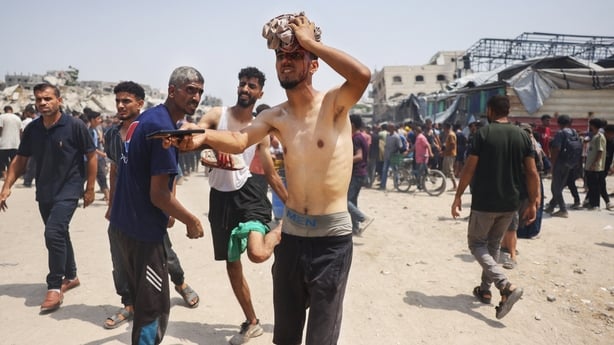 An injured man presses a cloth on his head wound