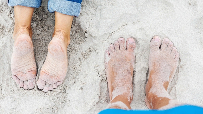Expert tips to keep your feet in top condition post-summer (Alamy/PA)