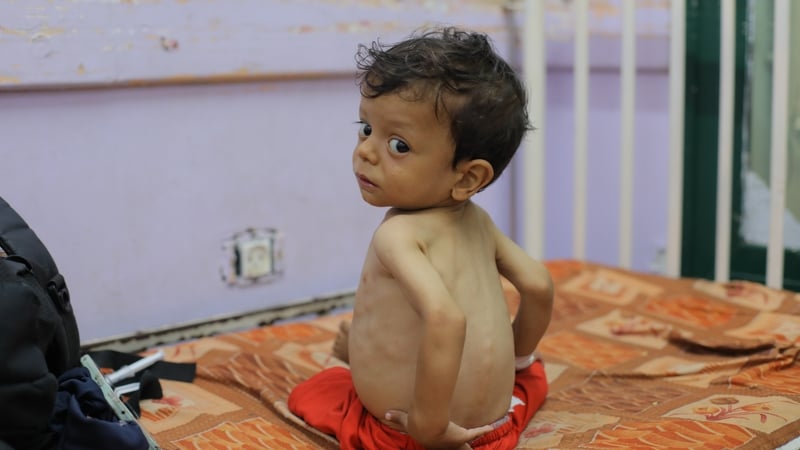 Severely malnourished children receive medical treatment at the Al-Aqsa Martyrs Hospital in Deir al-Balah