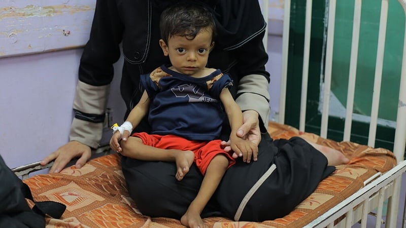 A malnourished child receives medical treatment at the Al-Aqsa Martyrs Hospital in Deir al-Balah, Gaza