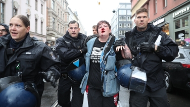Irish demonstrator assaulted by German police during pro-Palestine protest