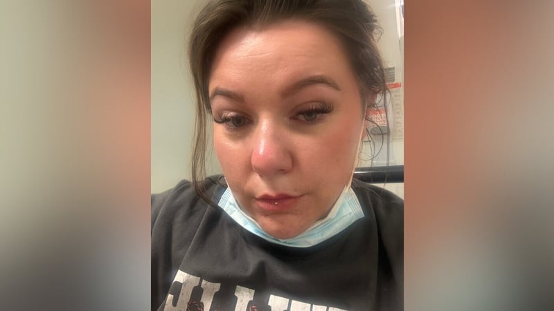 Thirty-one-year-old Amie Berns from Co Wicklow has stage three endometriosis and has been struggling since the age of 14 with really bad periods