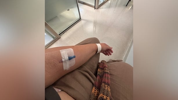 A view of Amie Berns arm while in hospital