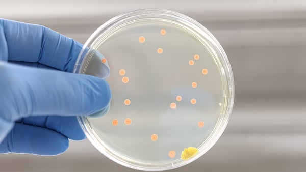 Blue glove of a doctor or researcher with a Petri dish containing orange colonies of bacteria