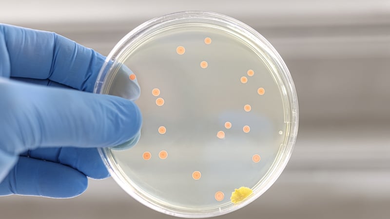 'Sepsis is most commonly caused by infections in the lungs, urinary tract or gastro-intestinal tract'. Photo: Getty Images