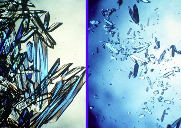 Comparison of space-grown (left) and Earth-grown (right) protein crystals.