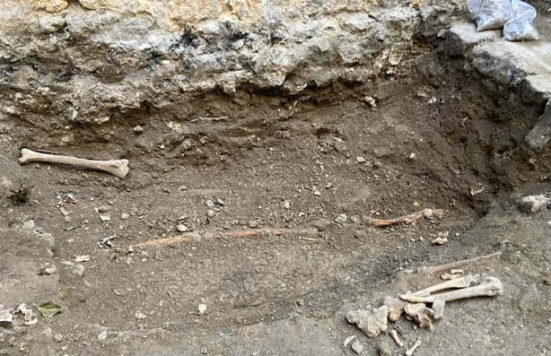 bones-dna-sarsfield-RTE