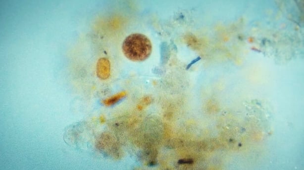 microplastics in water from Dublin Bay