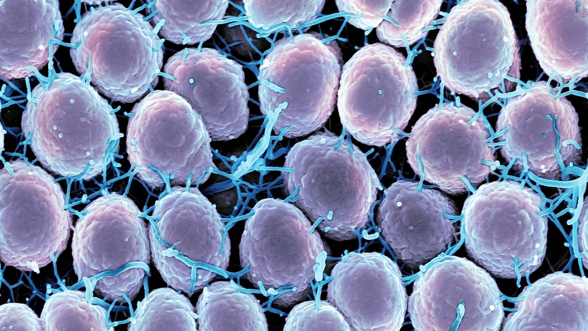 Over 20,000 cases of sexually transmitted diseases reported last year