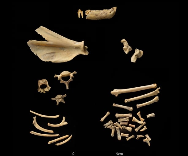 Bone fragments on a black background