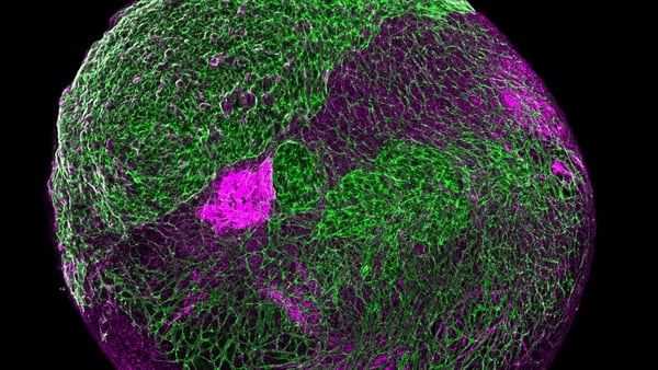 Undated handout photo issued by the University of Galway of a collection of cells in the research of 'mini-brains'