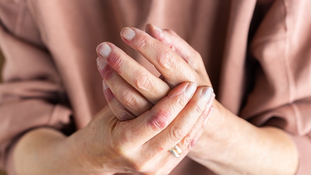 Close up of elder woman hands with eczema