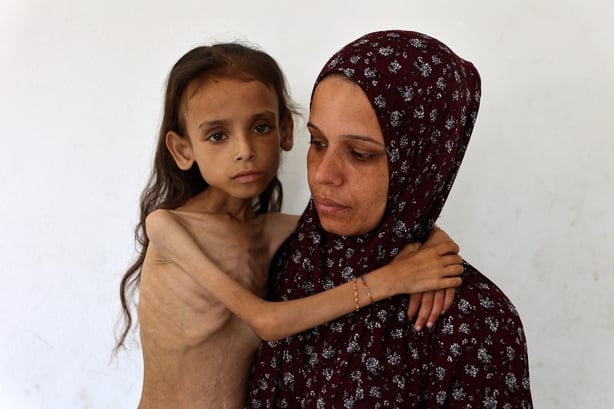 TOPSHOT - Nine-year-old malnourished Palestinian girl Mariam Dawwas is carried by her mother in the Rimal neighbourhood in Gaza City on August 2, 2025. Dawwas' mother, Modallala, 33, who is living with her family in a displacement camp in the northern Gaza Strip, said her daughter had no known illne