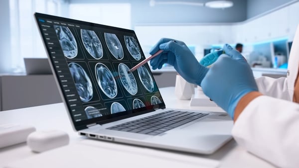 A radiology technician pointing at brain scans on a laptop