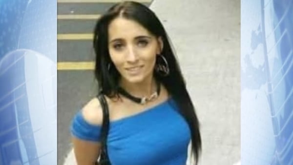 Image of Alexis Campion, who was seriously injured and suffered life changing burns to her face and body during an attack