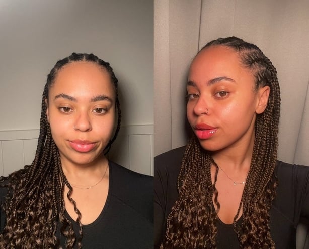 Before and after the validation facial (Sara Keenan/PA)