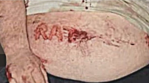The 'RAT' branding on Barry Moore's stomach
