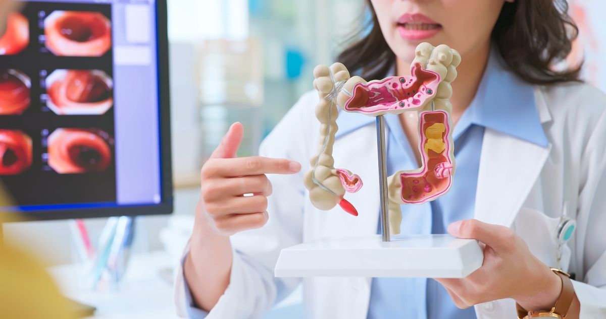 HSE to expand its bowel screening programme 