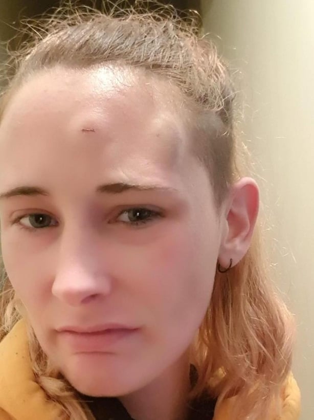 Sophie Armstrong Injury